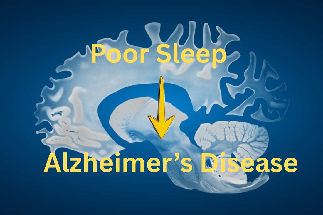 Poor Sleep Increases Alzheimer's Risk 5X (New Science)